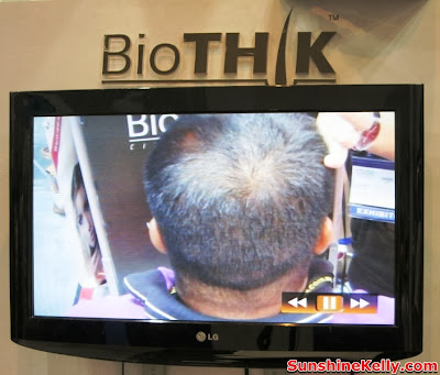 BioTHIK, BioTHIK pro, Instant Hair Transplant, hair Loss Treatment, hair building fiber