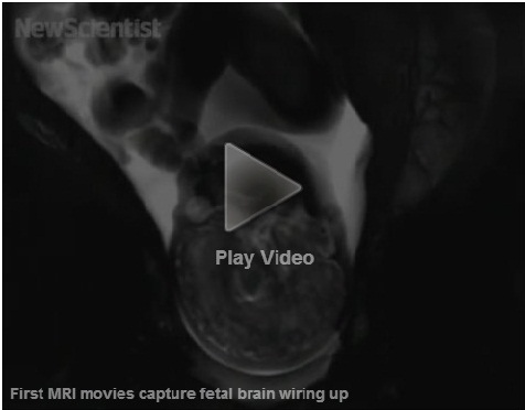 Vídeo: Primeras películas de un MRI capturan la conexión del cerebro en un feto.