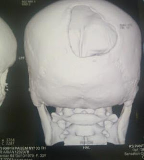 Hasil CT Scan ibu Paijem