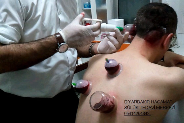 diyarbakir hacamat 05414264842 temmuz 2013