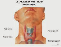 http://www.obatdemamkelenjar.com/2014/03/obat-kelenjar-getah-bening.html