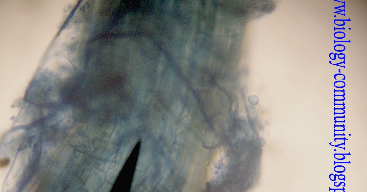 Membuat Preparat Akar yang Terinfeksi MVA (Mikoriza