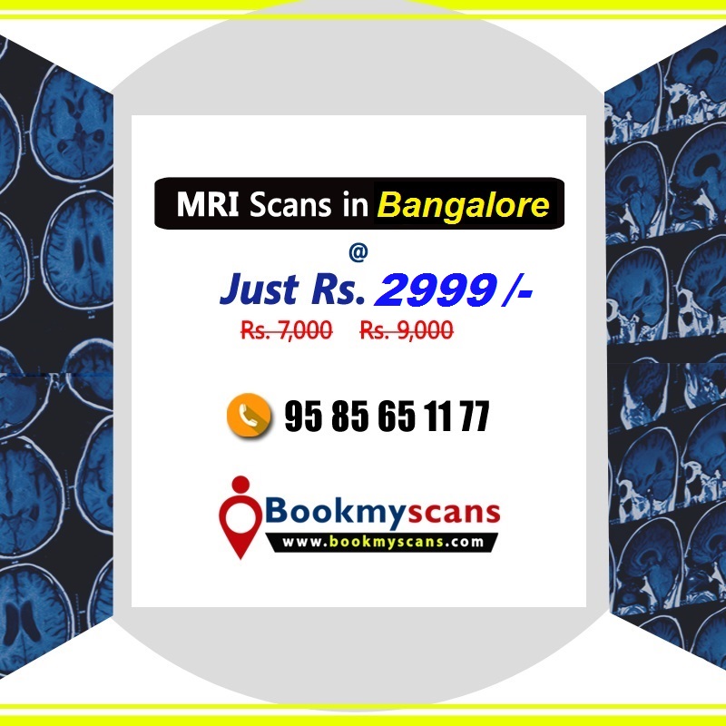 MRI Scans in Bangalore Rs.2999/-