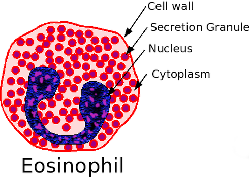 high Eosinophilia Homoeopathy Treatment in Chennai