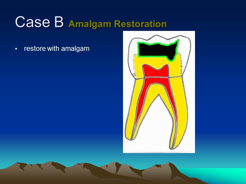 Dentistry Sealers, Liners and Bases