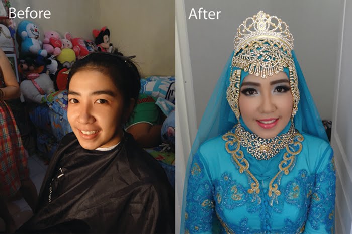 Before After 4