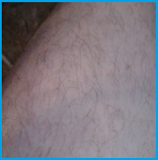 hairy sasquatch leg