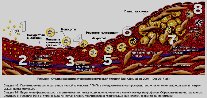 эндотелиальная дисфункция диагностика эндотелиальная дисфункция диагностика