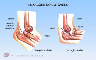 Luxação de Cotovelo.