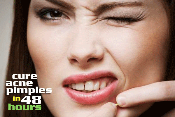 Home remedies for pimples fast, secrets to healthy skin and hair