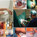 Cara Menghilangkan Hemoroid (Ambeien) Secara Permanen thumbnail