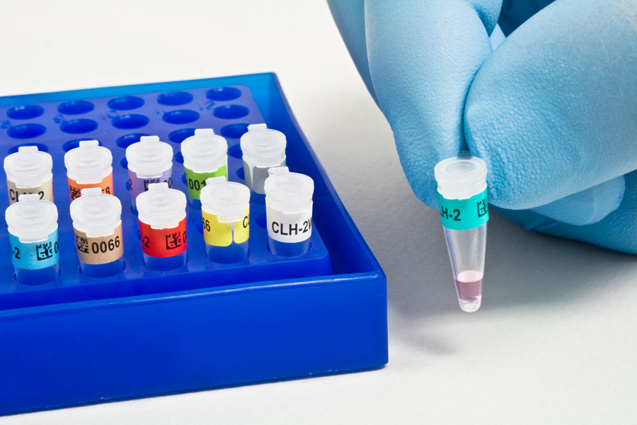 ПЦР на ИППП ПЦР анализы на оральные ИППП