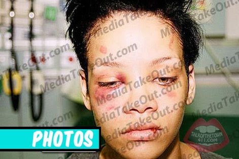 rihanna pics leaked by chris brown. New leaked of Rihanna have