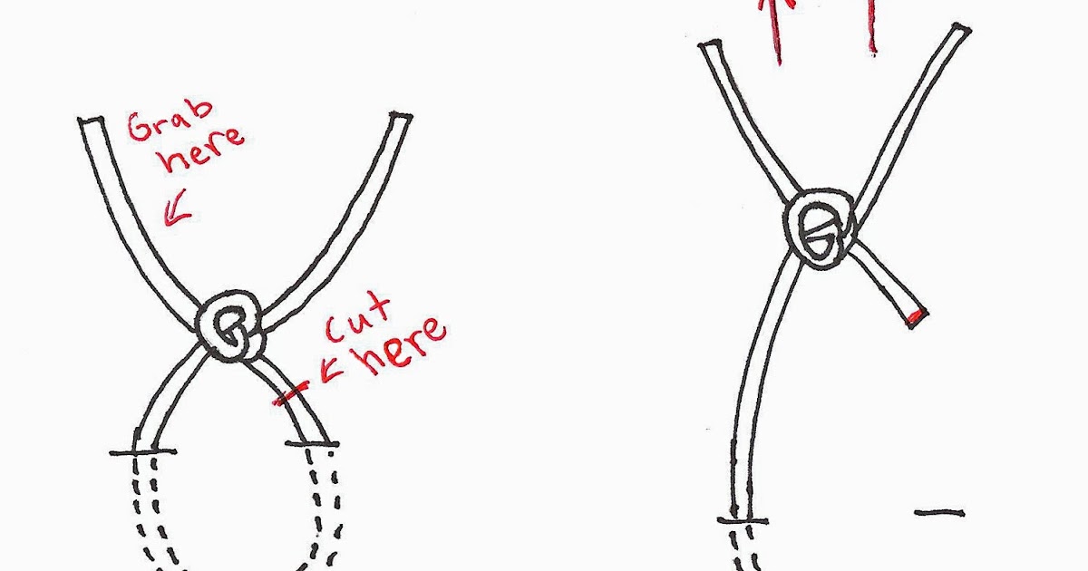 Suture Removal Chart