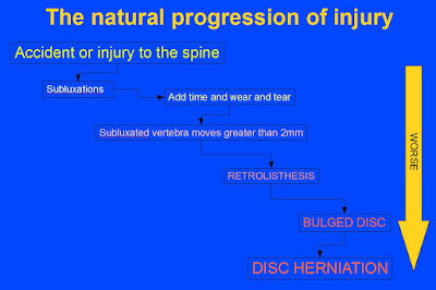 Grade 1 retrolisthesis l5-s1 picture