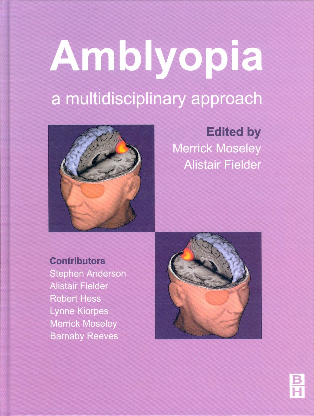 wright handbook of pediatric strabismus and amblyopia pdf download