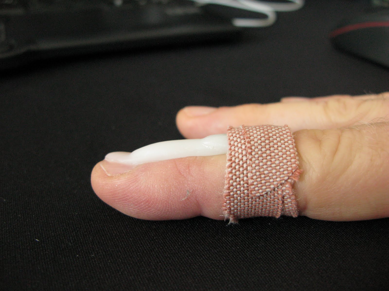 custom finger tip splint