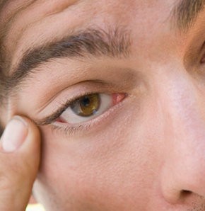 sorunuzun cevabi goz kurulugu neden olur belirtileri