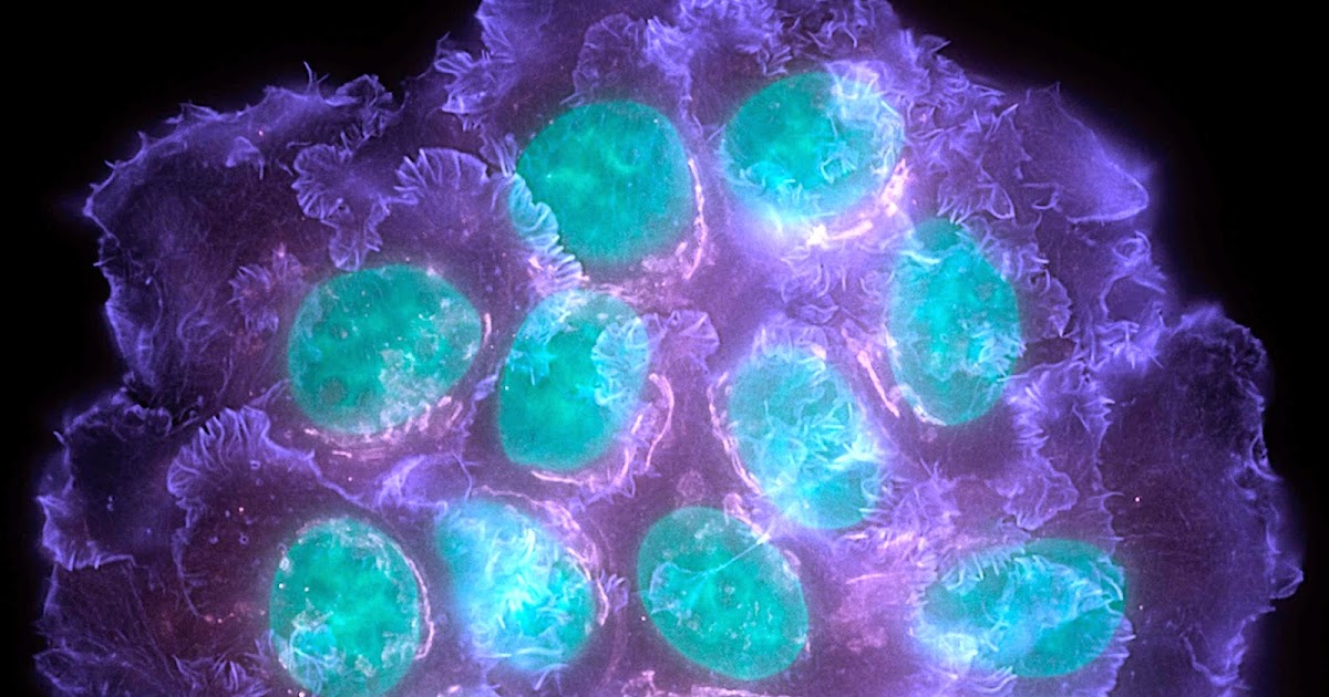 responsible breast cancer for Genes Farwick recommends Free triple b bondage thumbnails