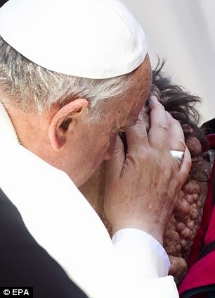 pope francis man covered kissed touching moment boils held huge disfigured