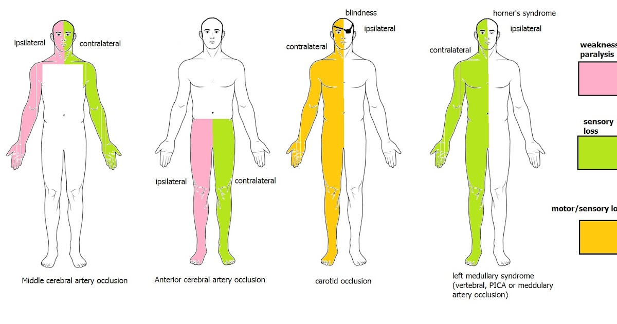 PLAB king Right sided weakness, left sided blindness (64/1700)