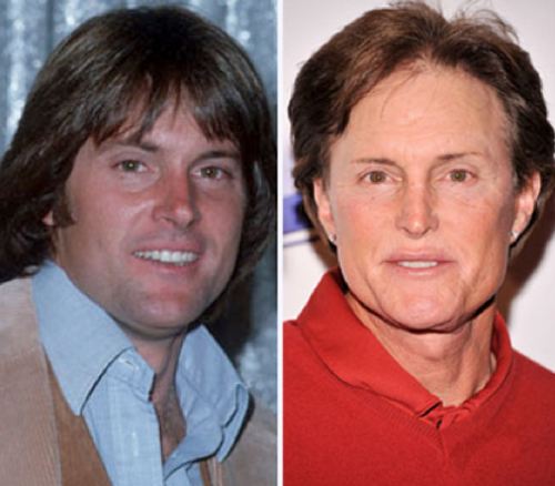 Free General Fashion: Bruce Jenner Plastic Surgery: Before And After