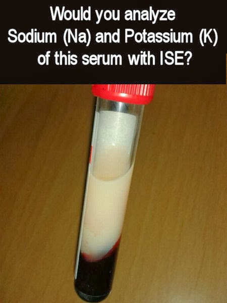 Концентрированная сыворотка Analyse Me Serum купить со скидкой в секс шопе  Лубриканты  Анальные