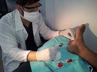 Dr Felipe realiza procedimento no pé do jovem paciente.