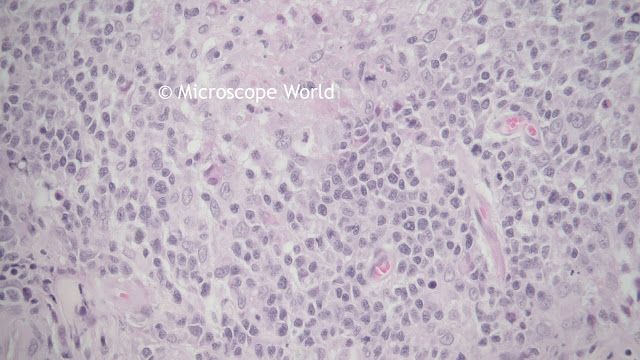 Image of tissue captured under a biological microscope.