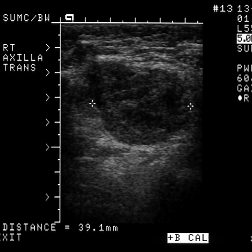 Doctor's knowledge Melanoma