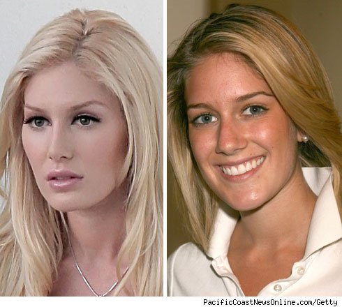heidi montag before and after 10 plastic surgery. wallpaper Heidi Montag