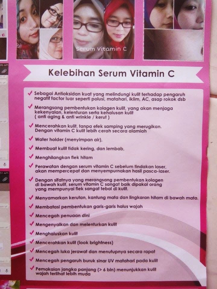serum vitamin c nn pretty room serum vitamin c nn pretty room