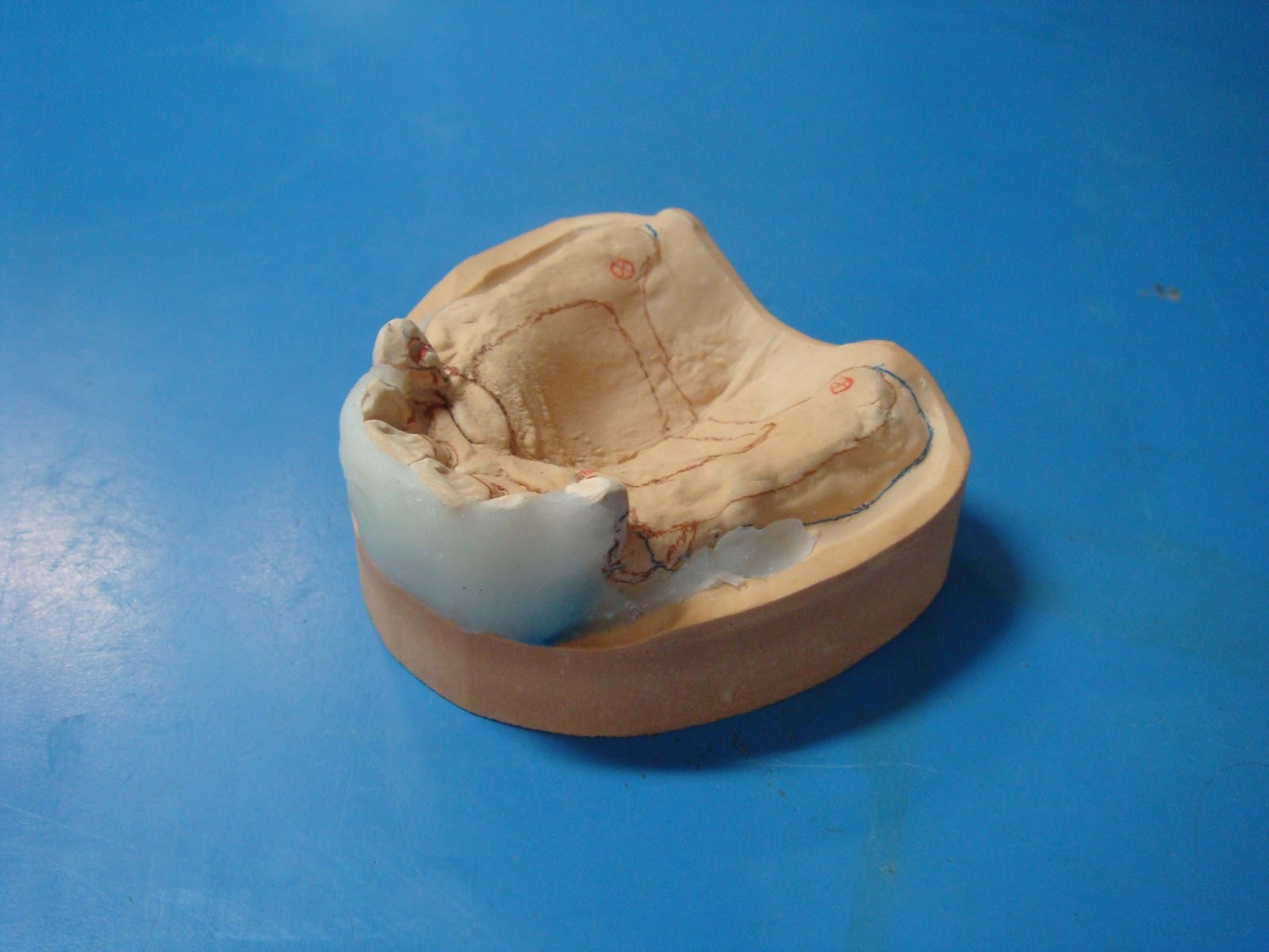 Step by step Guide for Understanding the Prosthodontics A step by step