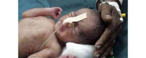 10 Bayi Paling Besar yang Pernah Dilahirkan