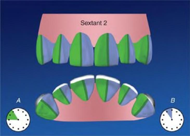 sextant of teeth dentistry lectures for mfds mjdf nbde ore principles of sextant of teeth dentistry lectures for mfds mjdf nbde ore principles of