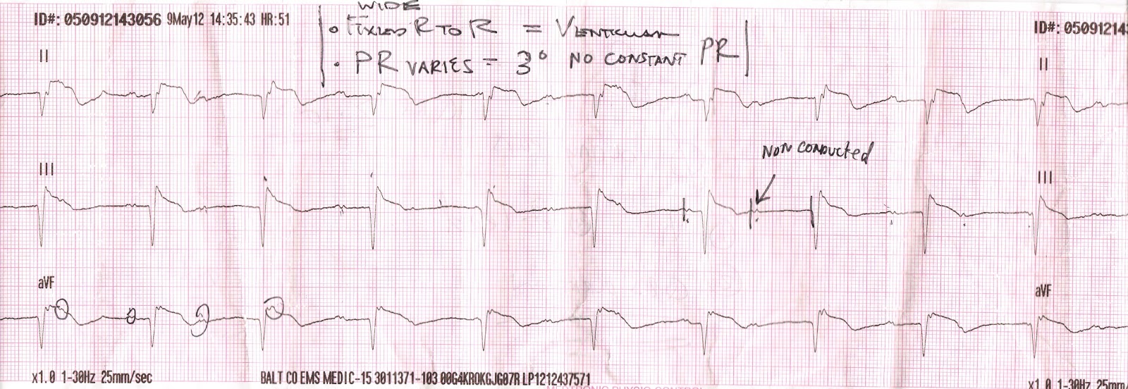 ECGs for EMS The Deceptive Ears of a Rabbit