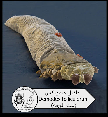 طفيل ديمودكس Demodex folliculorum (عث الوجه)