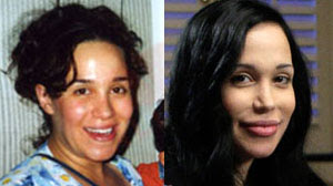 nadya-suleman-before-and-after.jpg