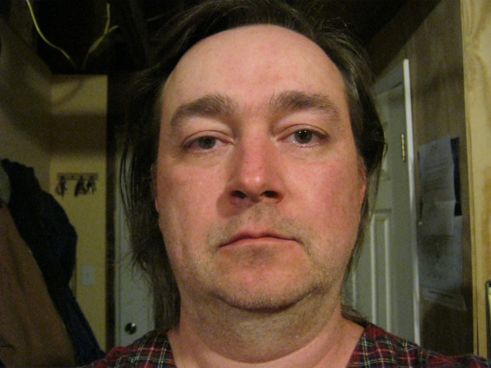 Clover Leaf Deformity