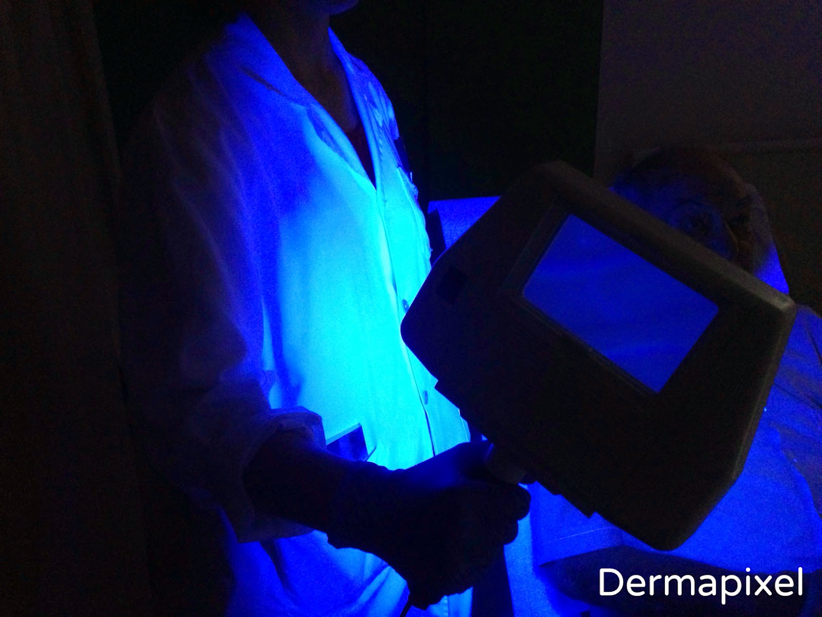 Dermapixel: Hipomelanosis macular progresiva y la magia de la lámpara de  Wood
