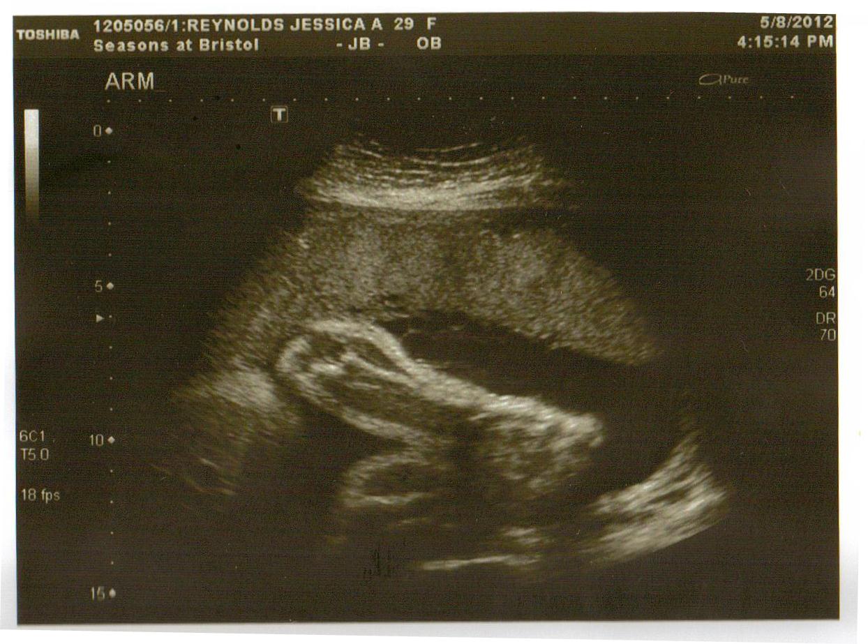 Little Ella Reynolds Week 33 ultrasound