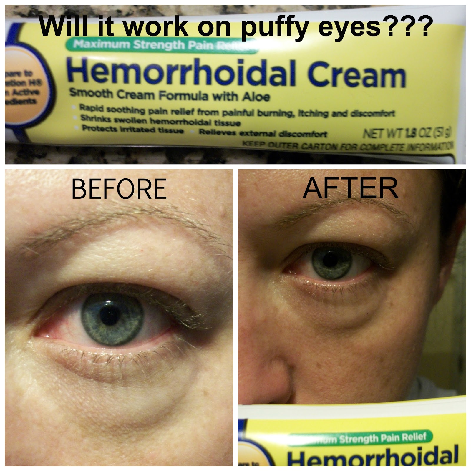 The Real Mom Review Does Hemorrhoid Cream Really Depuff Eyes?