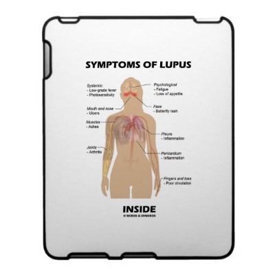 In adults, about nine of every 10 cases of lupus occur in women. .. discoid lupus  will go on to develop other symptoms that are consistent with systemic lupus.