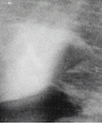 Blog+Picture.JPG