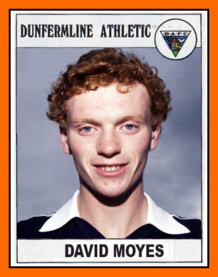 Who's the Uggliest footballer ever? David+MOYES