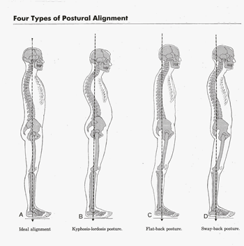 Posture Back
