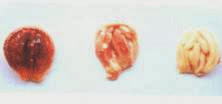 Hình 3: Túi Fabricius sưng to, đỏ, xuất huyết lấm tấm