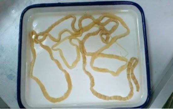 Parasitas de peixe de uma larva