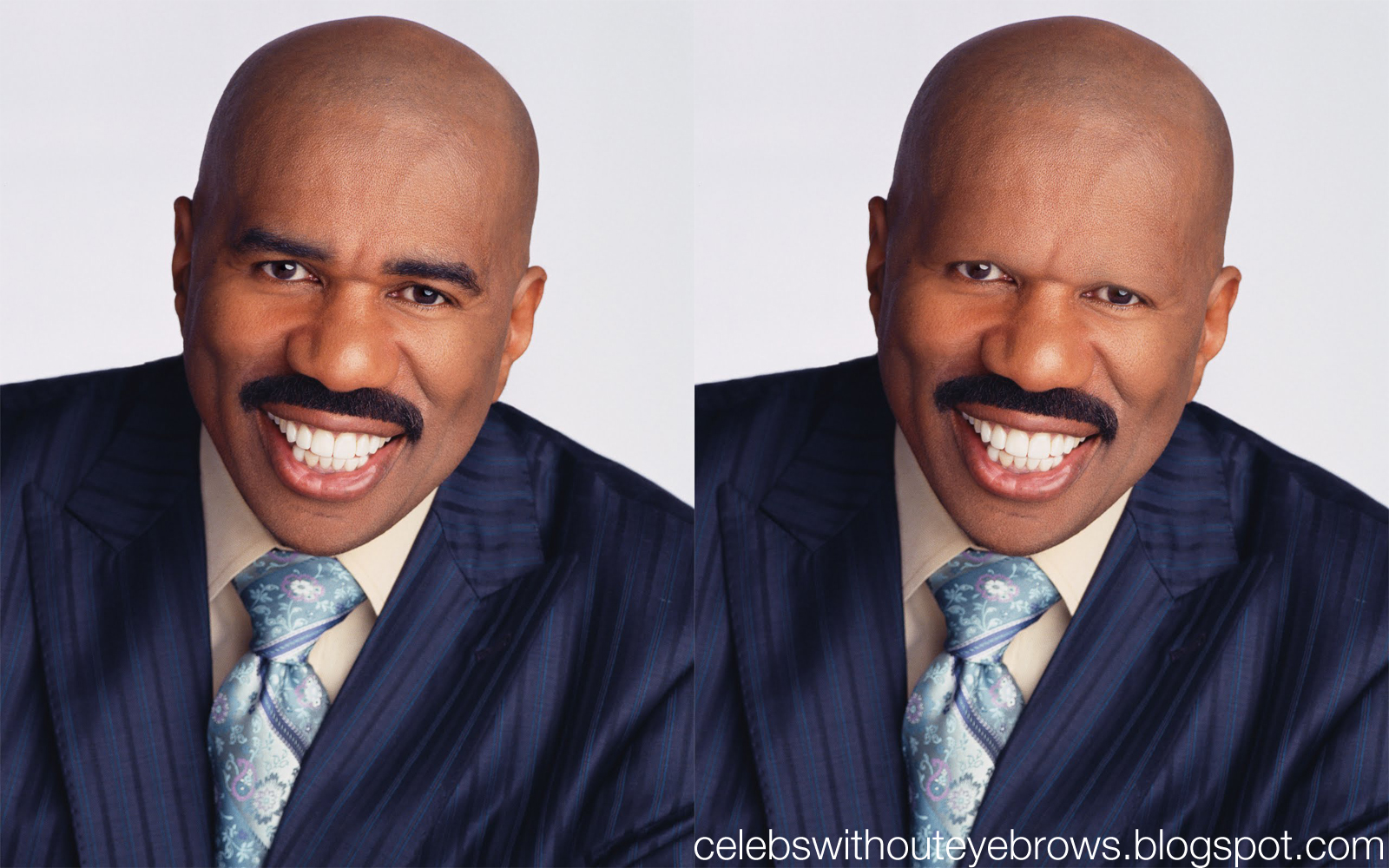 celebrities without eyebrows and teeth