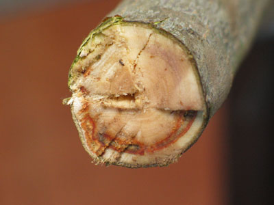 Como sanar el hongo con levadura de las uñas en los pies